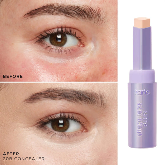 Alura Lift Stick